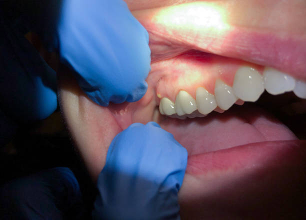 Best Mobile Emergency Dentist in Salamatof, AK
