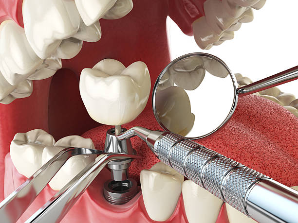 Best Emergency Dentist for Special Needs Patients in Salamatof, AK